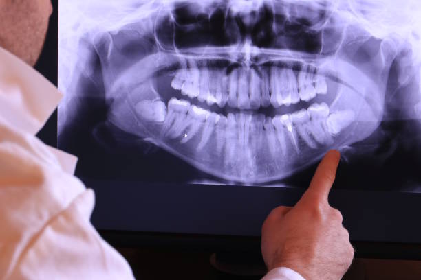 Best Dental Abscess Treatment in Cape Girardeau, MO