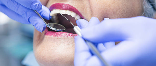 Best Walk-In Emergency Dental Services in Cape Girardeau, MO